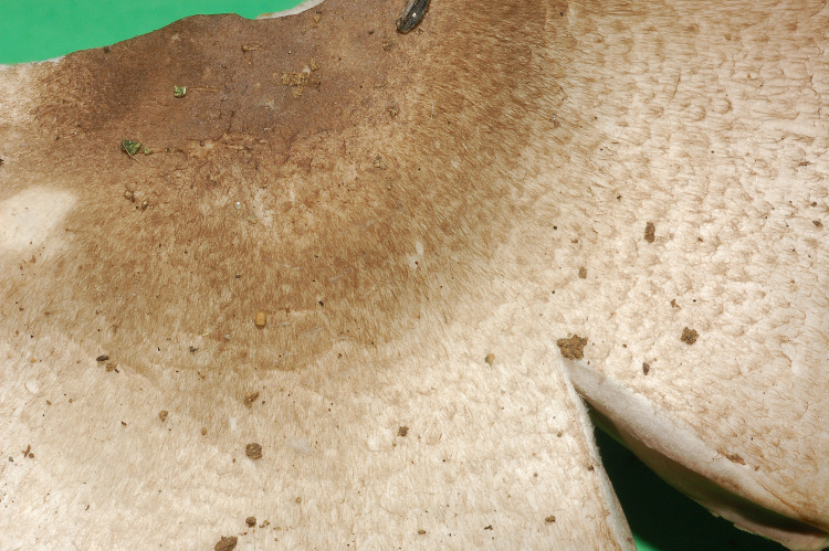 A. xantoderma?